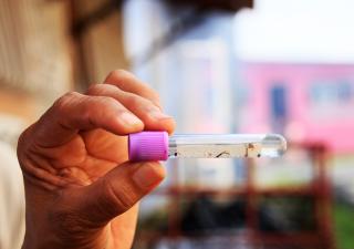Autocuidado: clave para prevenir enfermedades