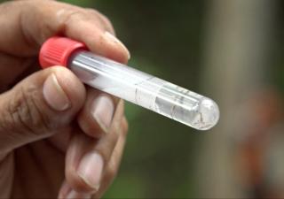Minsa reitera no bajar la guardia y prevenir el Dengue